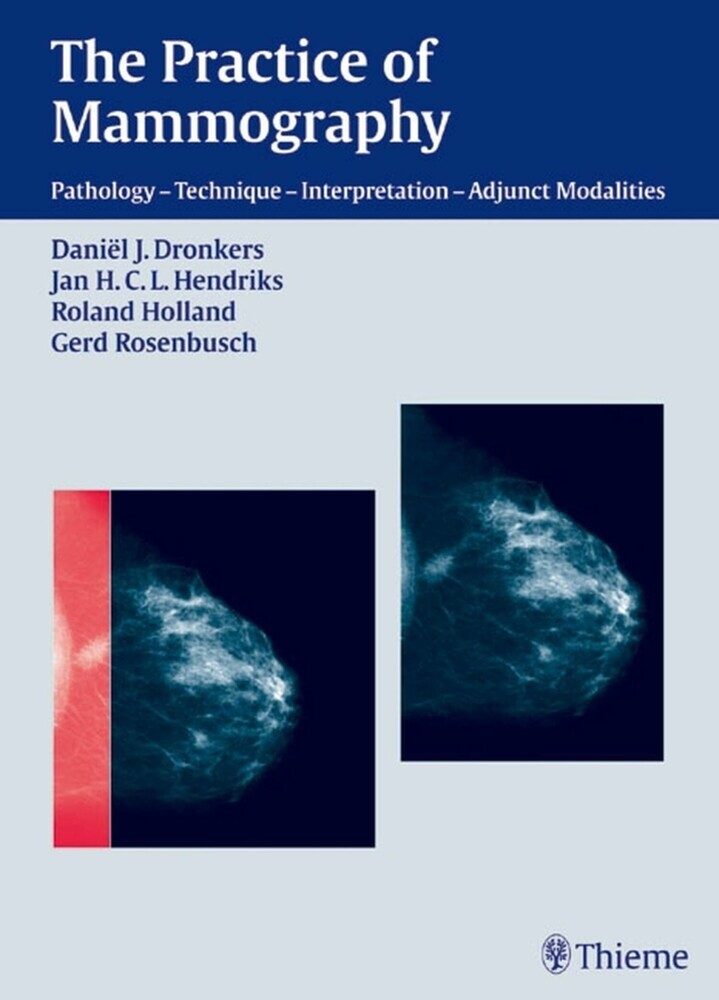 The Practice of Mammography