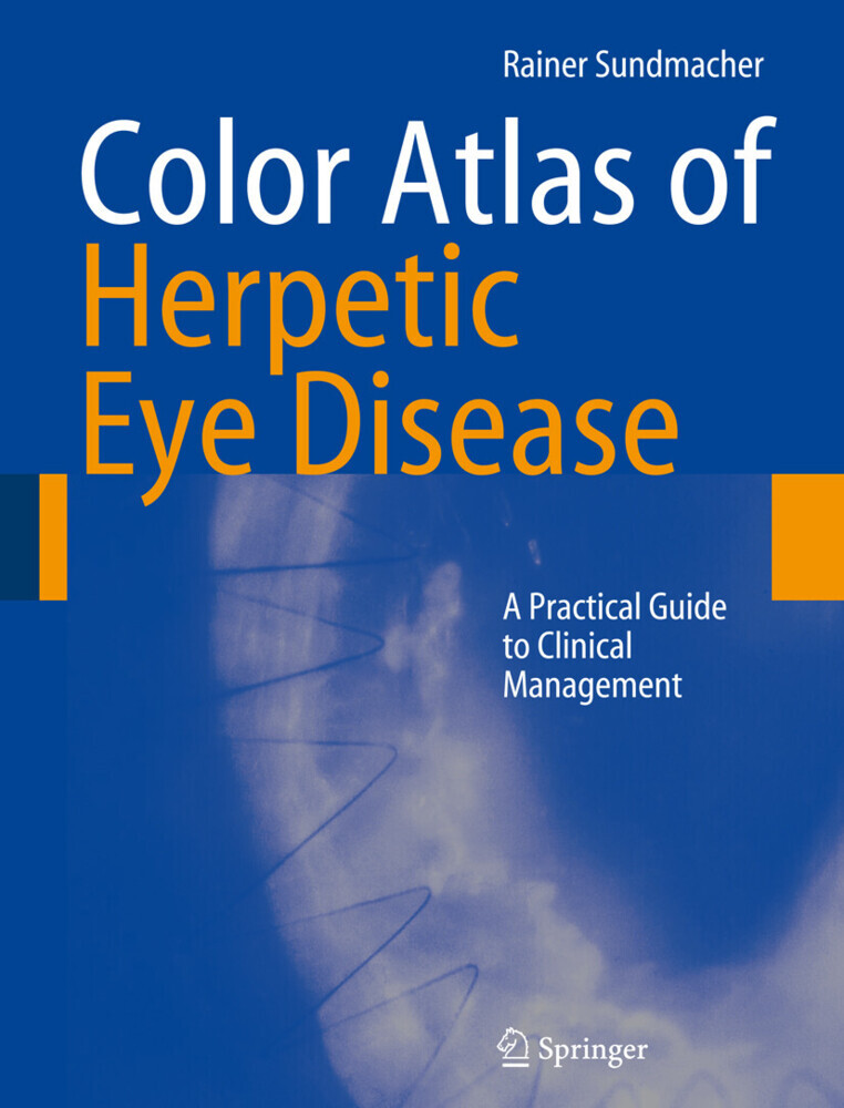 Color Atlas of Herpetic Eye Disease