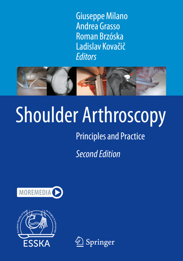 Shoulder Arthroscopy