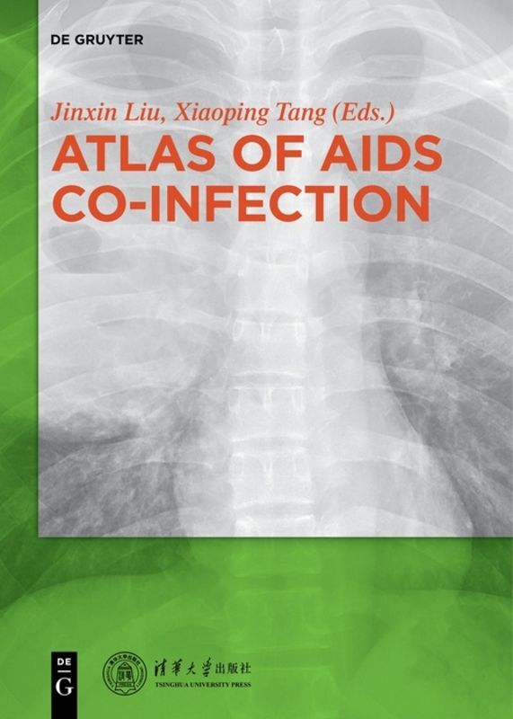 Atlas of AIDS Co-infection