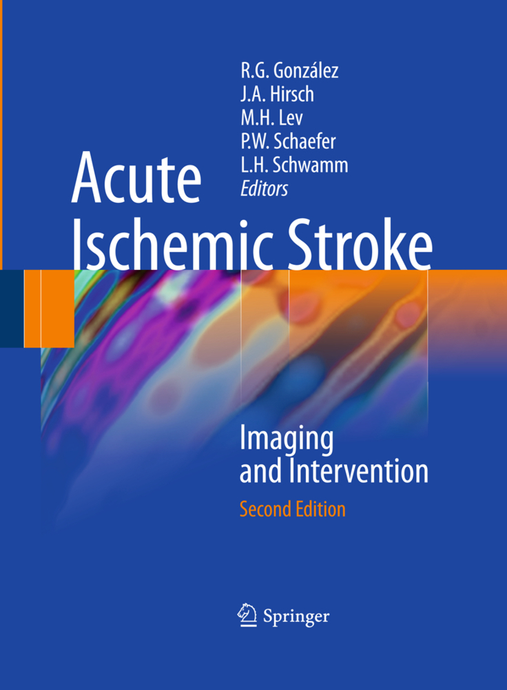 Acute Ischemic Stroke