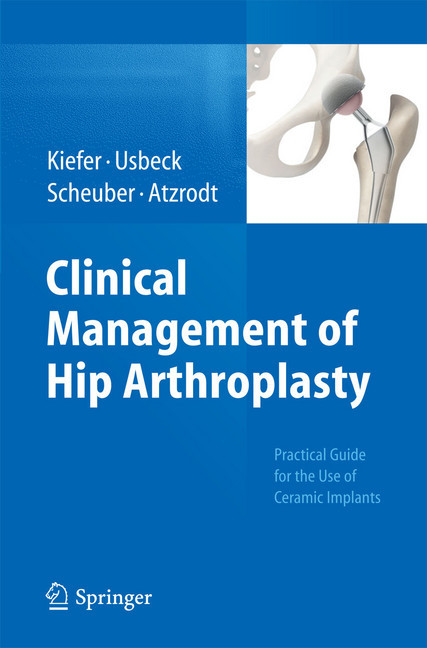 Clinical Management of Hip Arthroplasty