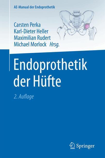 Endoprothetik der Hüfte