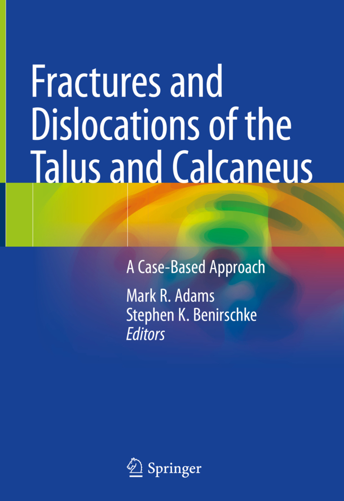 Fractures and Dislocations of the Talus and Calcaneus