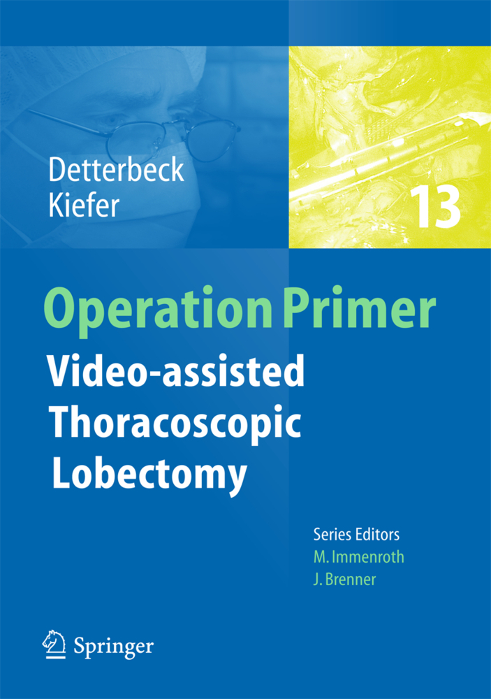 Video - assisted Thoracoscopic Lobectomy