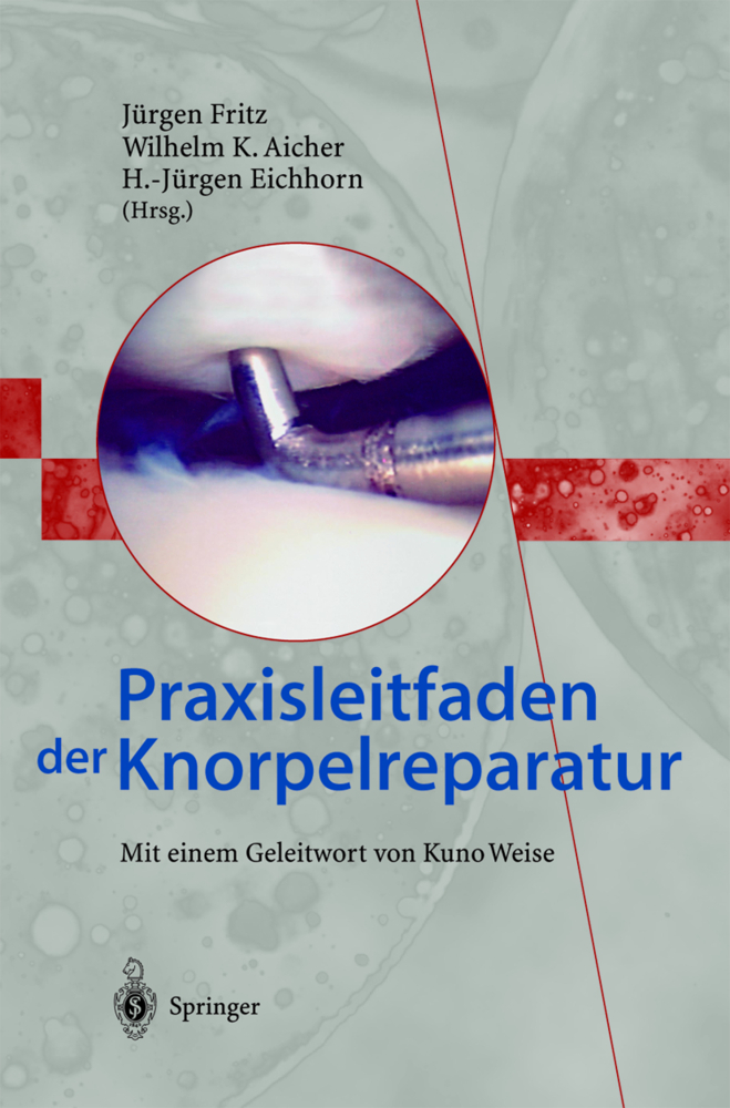 Praxisleitfaden der Knorpelreparatur