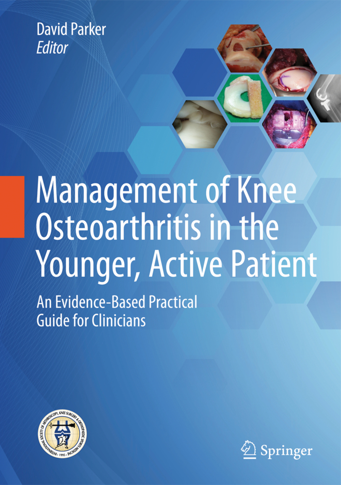 Management of Knee Osteoarthritis in the Younger, Active Patient