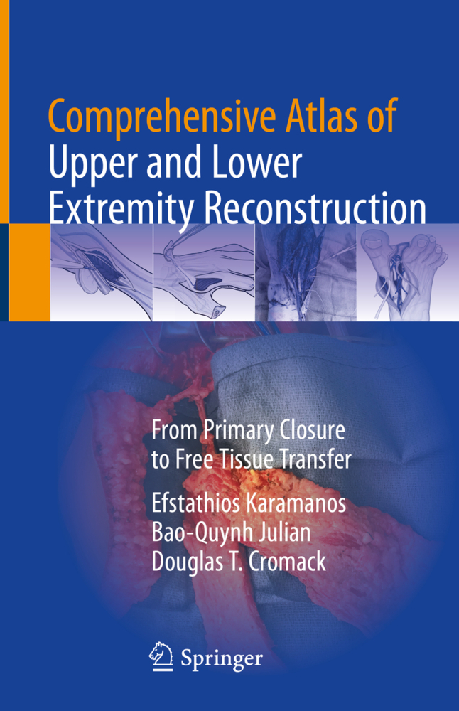Comprehensive Atlas of Upper and Lower Extremity Reconstruction