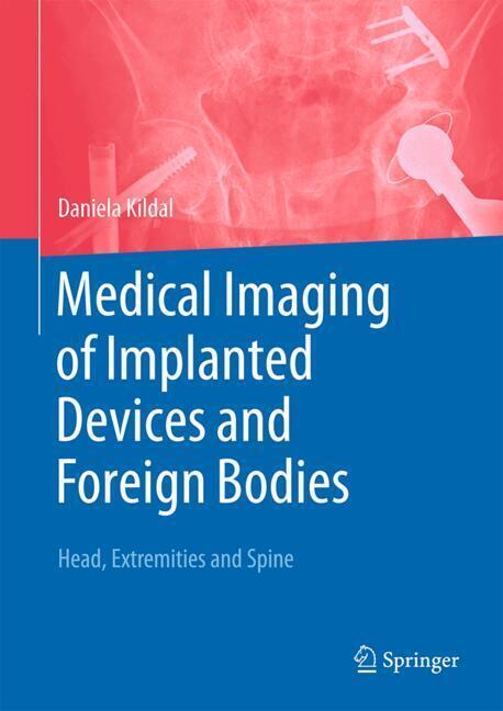 Medical Imaging of Implanted Devices and Foreign Bodies