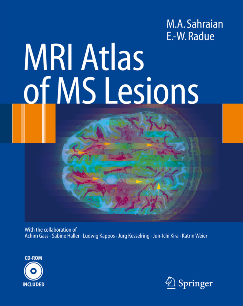 MRI Atlas of MS Lesions, w. CD-ROM
