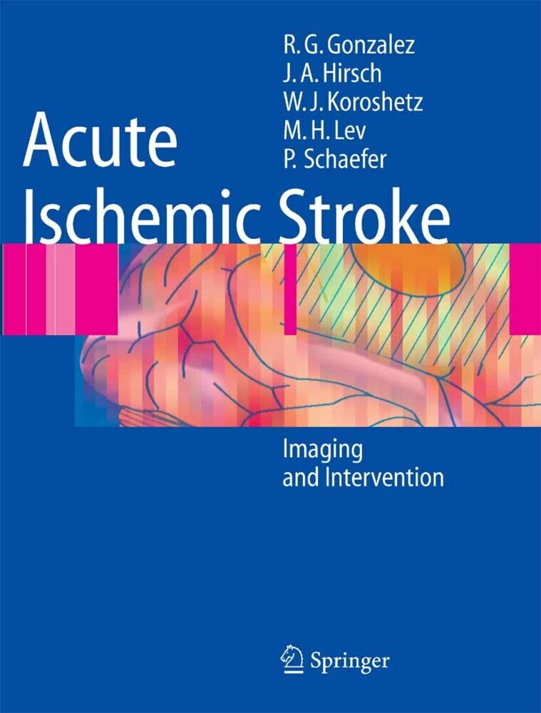 Acute Ischemic Stroke