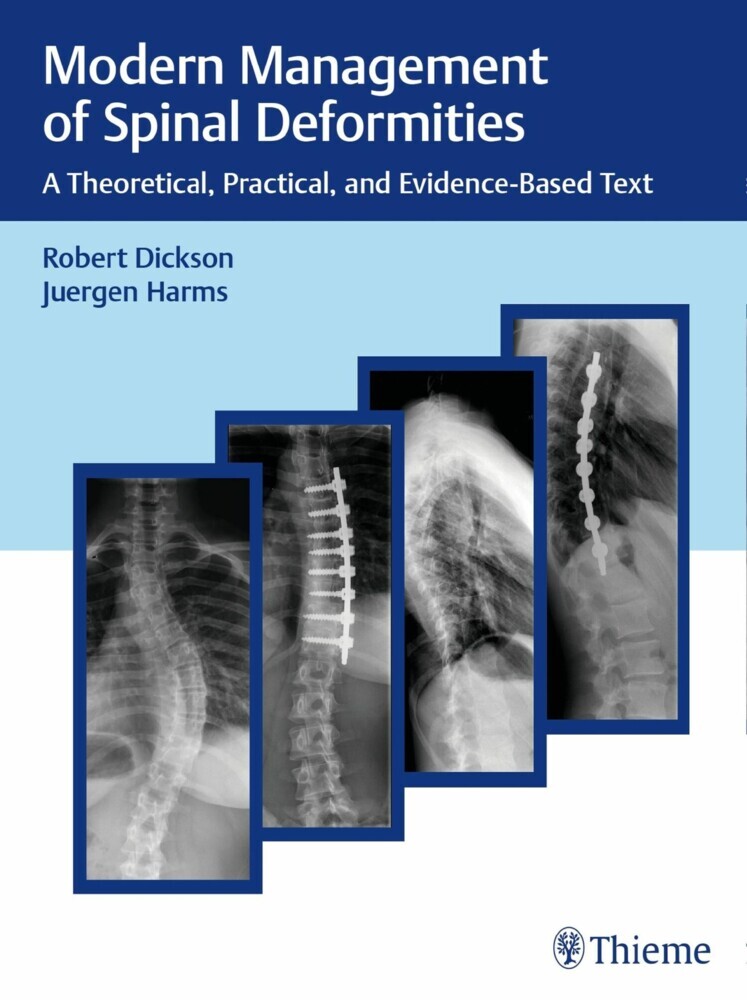 Modern Management of Spinal Deformities