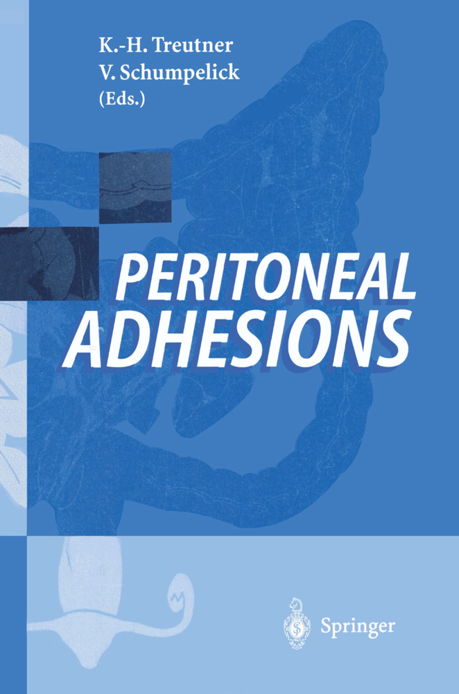 Peritoneal Adhesions