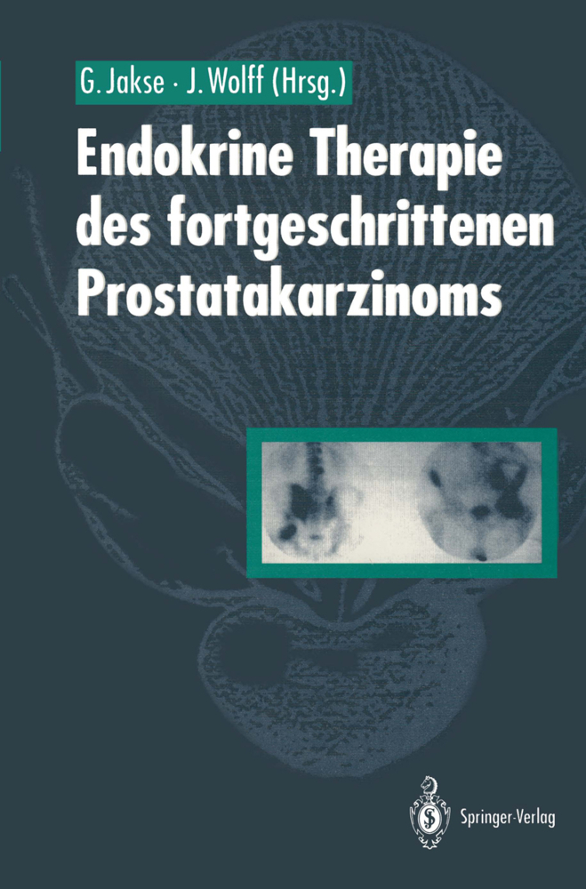 Endokrine Therapie des fortgeschrittenen Prostatakarzinoms