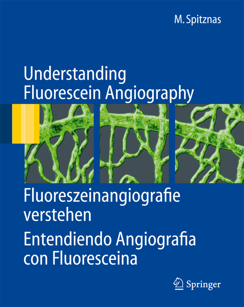 Understanding Fluorescein Angiography, Fluoreszeinangiografie verstehen, Entendiendo Angiografía con Fluoresceína