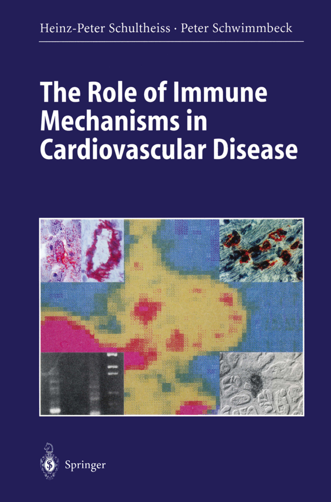 The Role of Immune Mechanisms in Cardiovascular Disease