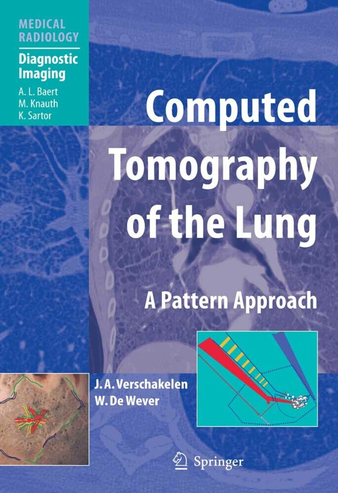Computed Tomography of the Lung