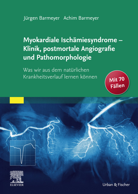 Die myokardialen Ischämiesyndrome - Klinik und postmortale Pathomorphologie