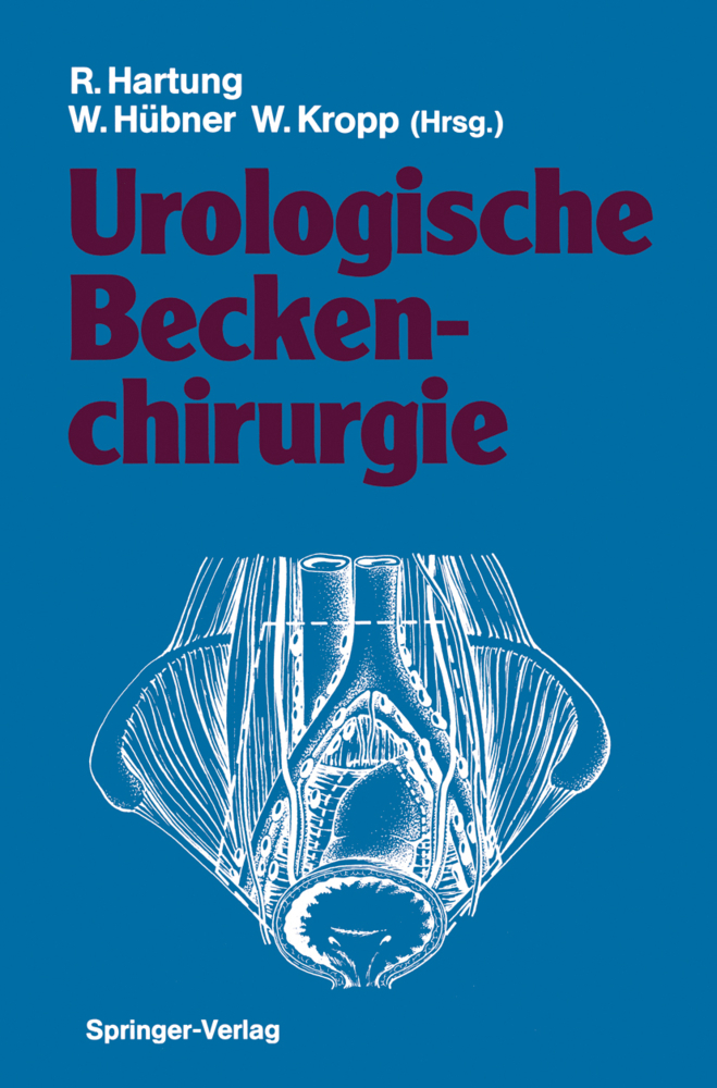 Urologische Beckenchirurgie