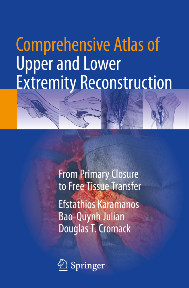 Comprehensive Atlas of Upper and Lower Extremity Reconstruction