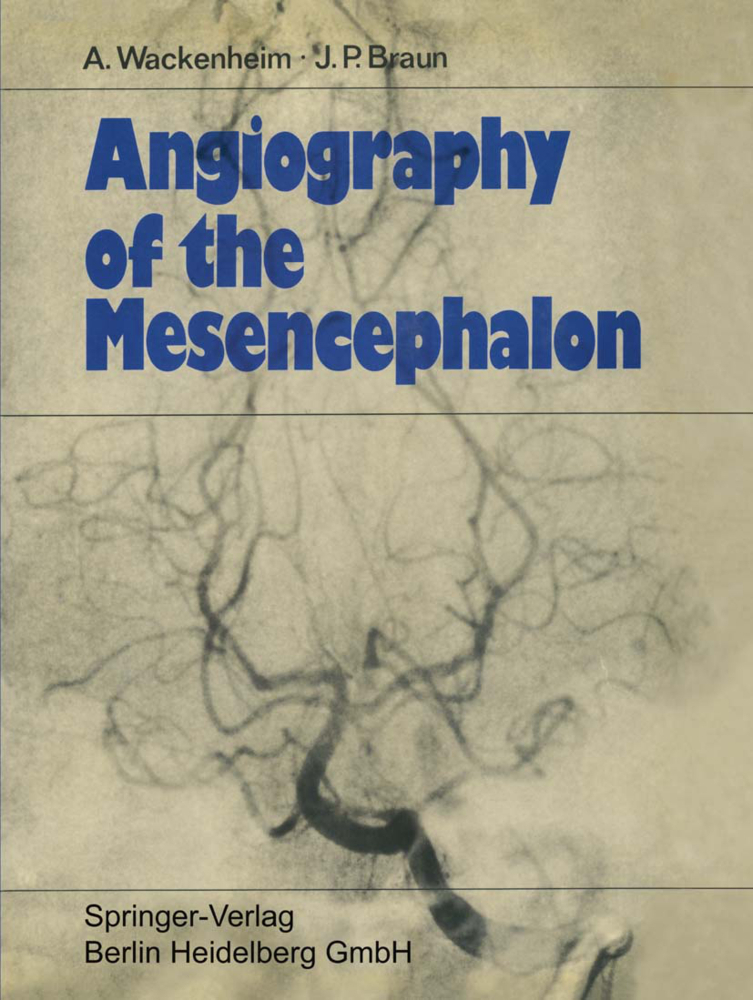 Angiography of the Mesencephalon