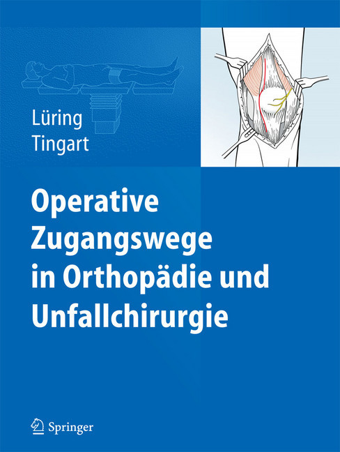 Operative Zugangswege in Orthopädie und Unfallchirurgie