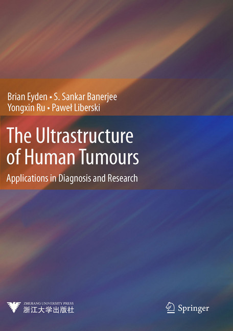 The Ultrastructure of Human Tumours