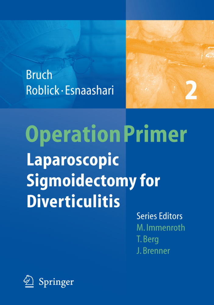 Laparoscopic Sigmoidectomy for Diverticulitis