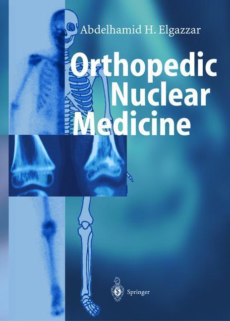 Orthopedic Nuclear Medicine