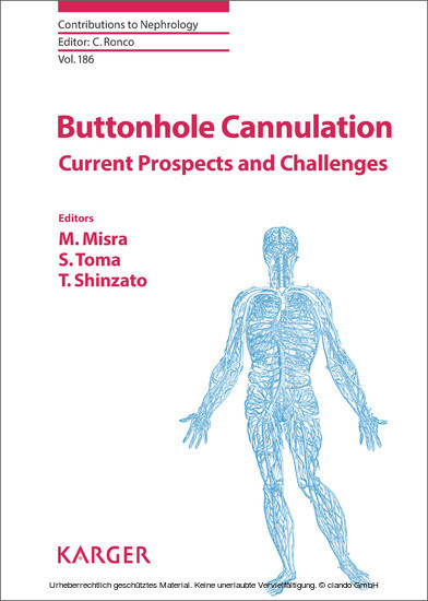 Buttonhole Cannulation