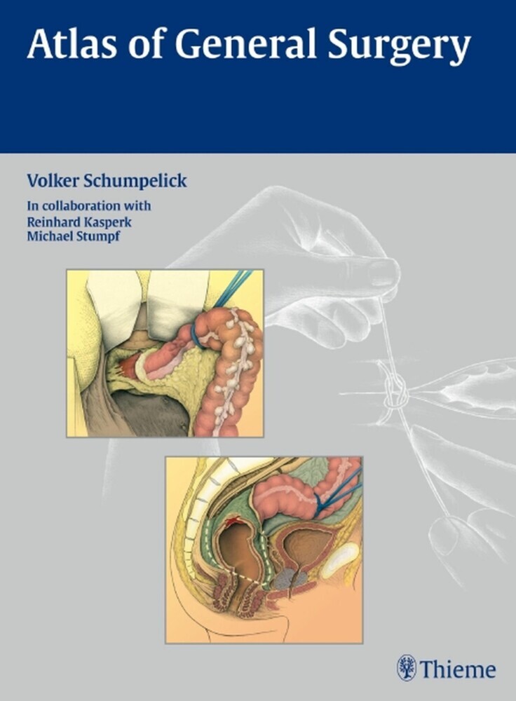 Atlas of General Surgery