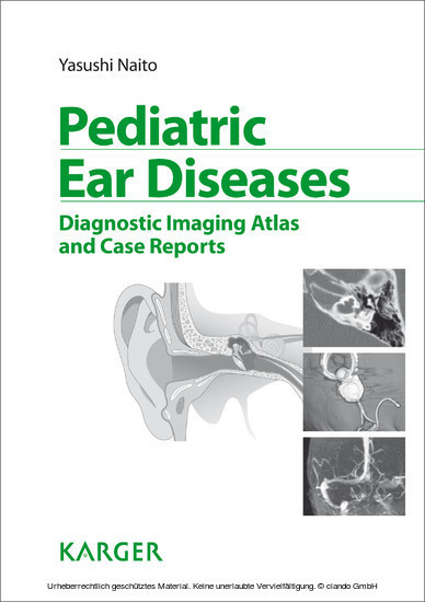 Pediatric Ear Diseases