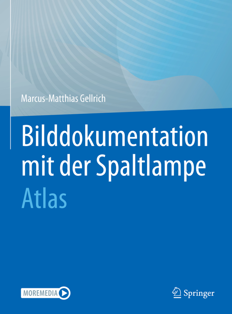 Bilddokumentation mit der Spaltlampe