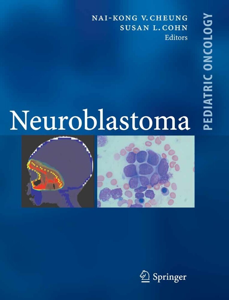 Neuroblastoma