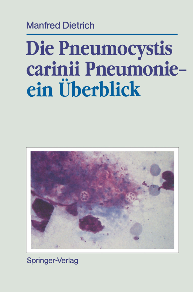 Die Pneumocystis carinii Pneumonie- ein Überblick
